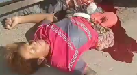 Biker Left With His Guts Exposed