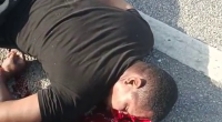 A Motorcyclist With A Shattered Skull Takes His Last Breaths