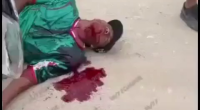 Dude Dying After Being Shot