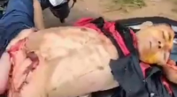 The Body Of A Motorcyclist Without Brains And With Intestines Falling Out