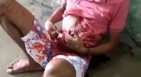 Dude Got Stabbed And Holding His Guts