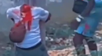Dude Beheaded In The Street By Haitian Savages