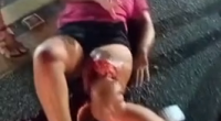 Her Leg Got Fucked Up