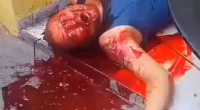 Dude Bleeding Out