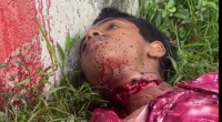 Rickshaw Driver Throat Slit