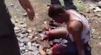 He Fell Off The Train & Got His Legs Mangled