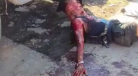 Aftermath Of Knife Fight