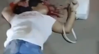 Woman's Skull Is Completely Crushed And A Bit Of Her Brain Leaked