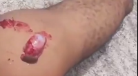 Guy Sexually Assaulting Lady Gets Neutered