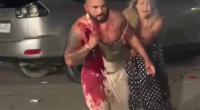 Dude Got Stabbed In His Chest During Fight