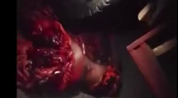 Biker Turned Into A Pile Of Meat