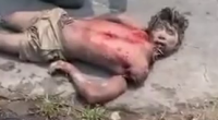 Dude Got Dismembered