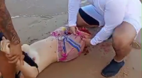 The Shark Deprived A 19-Year-Old Woman Of One Leg. Brazil