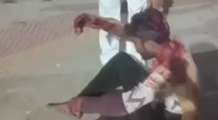 Idiot Lost Some Fingers When He Fell Under The Train