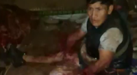 Idiot Lost Both Arms When A Homemade Bomb Exploded During A Quarrel With His Wife