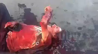 Old Dude Got Fucked Up By Dogs