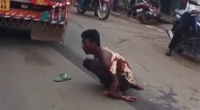 Bus Took His Arm