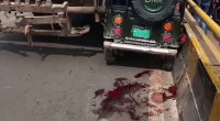 Lost Her Fucking Foot