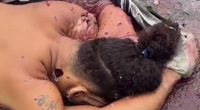 Police Bullets Hit The Bandit In The Face During An Unsuccessful Robbery