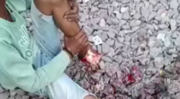 Train Fucked Up His Foot