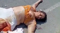 Female Biker Got Her Leg Shredded