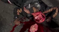 Dude's Head Split The Fuck Open