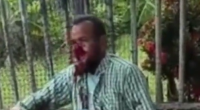 Dude Your Face Is Totally Fucked