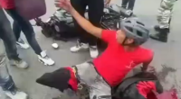 Biker's Leg Ripped Off