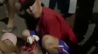 His Knee Cap Is Fucked