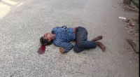 Cable Thief Got His Hand Zapped Off & Slowly Dying