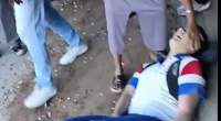 His Femur Bone Is Sticking Out