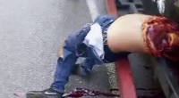 Motorcyclist Lost Arm And Life In Truck Accident
