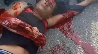 Maybe The Doctors Will Repair The Man's Arm...